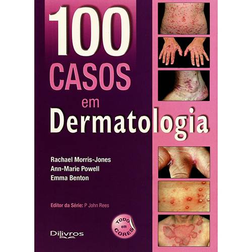 100 Casos em Dermatologia