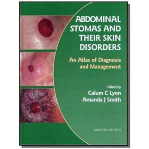 Abdominal Stomas And Their Skin Disorders