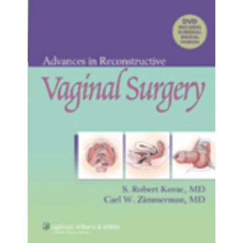 Advances In Reconstructive Vaginal Surgery