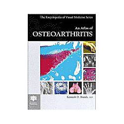 An Atlas Of Osteoarthritis