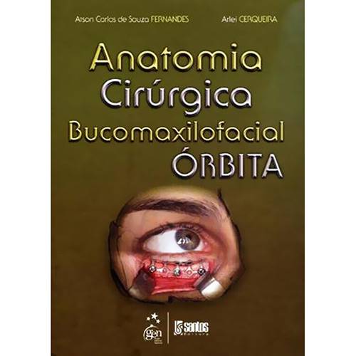 Anatomia Cirúrgica Bucomaxilofacial: Órbita