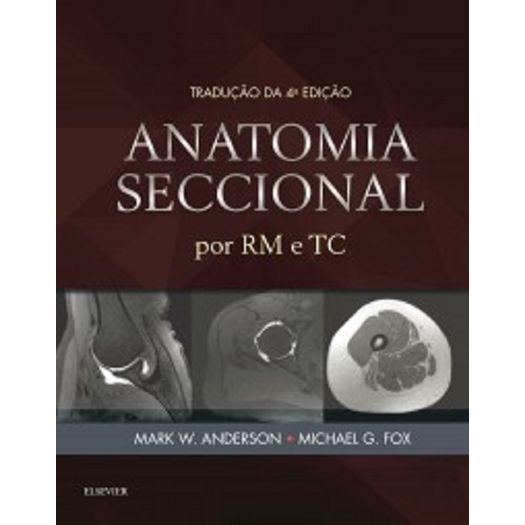 Anatomia Seccional por Rm e Tc - Elsevier