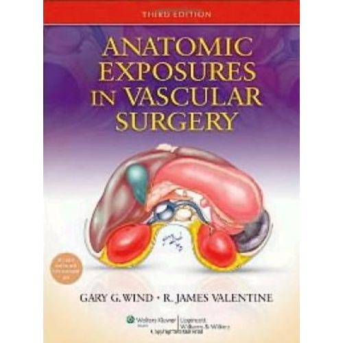 Anatomic Exposures In Vascular Surgery - Lippincott Williams & Wilkins