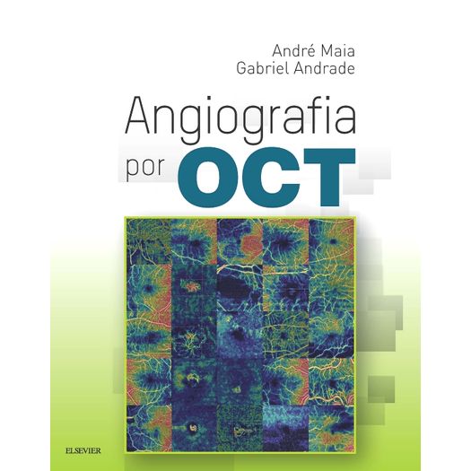 Angiografia por Oct - Elsevier