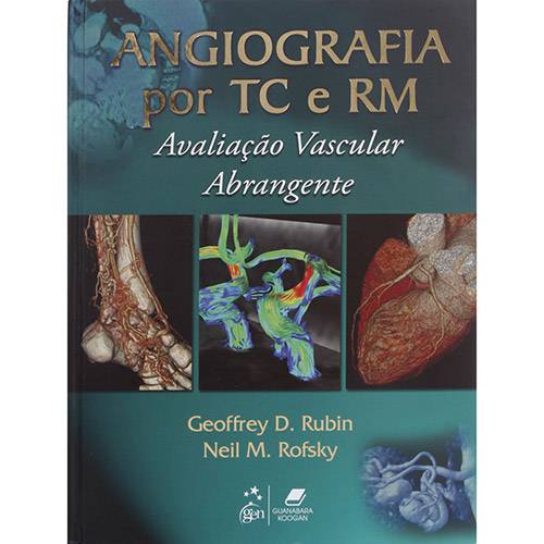 Angiografia por TC e RM: Avaliação Vascular Abrangente