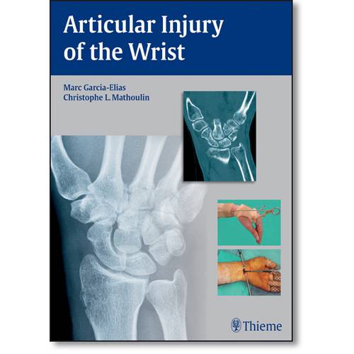 Articular Injury Of The Wrist