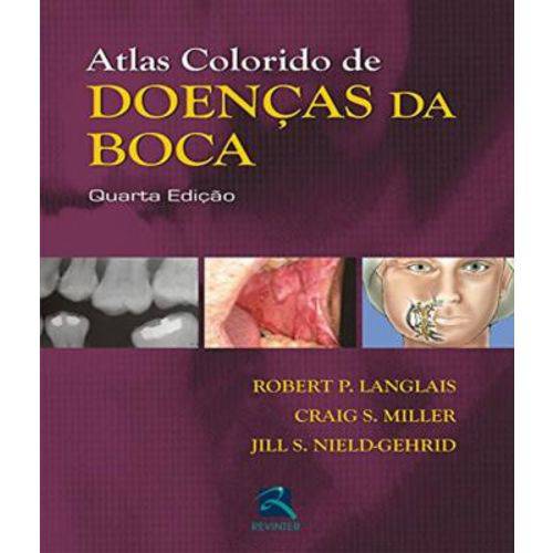Atlas Colorido de Doencas da Boca - 04 Ed