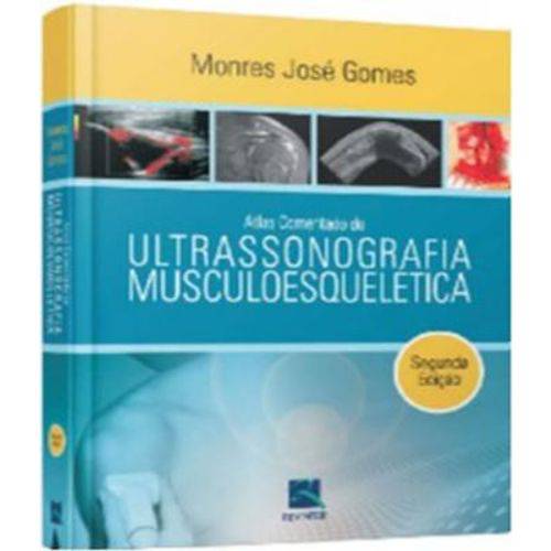 Atlas Comentado de Ultrassonografia - Musculoesqueletica