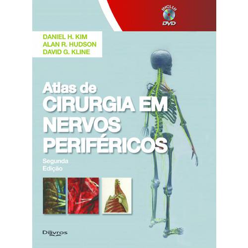 Atlas de Cirurgia em Nervos Periféricos