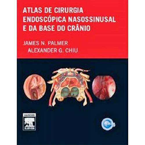Atlas de Cirurgia Endoscopica Nasossinusal - Elsevier