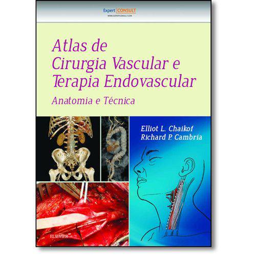 Atlas de Cirurgia Vascular e Terapia Endovascular