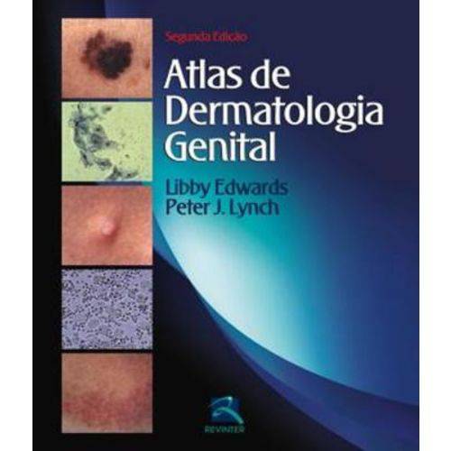 Atlas de Dermatologia Genital