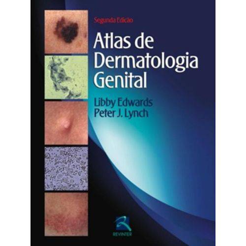 Atlas de Dermatologia Genital