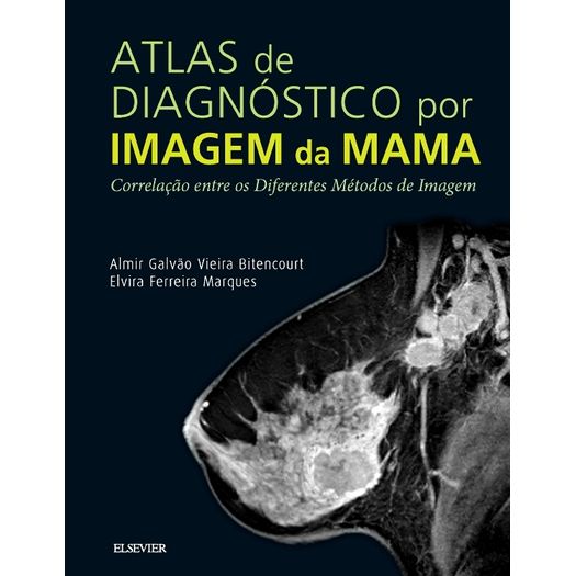 Atlas de Diagnostico por Imagem de Mama - Elsevier