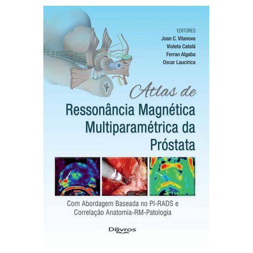 Atlas de Ressonancia Magnetica Multiparametrica da Prostata