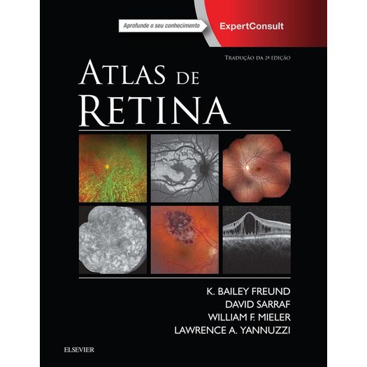 Atlas de Retina - Elsevier