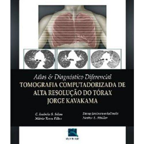 Atlas e Diagnostico Diferencial - Tomografia