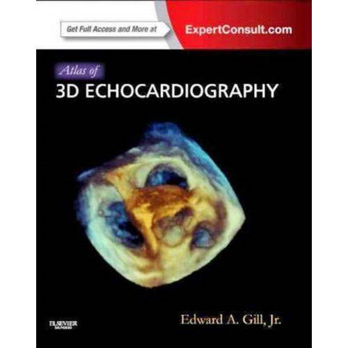 Atlas Of 3d Echocardiography - Expert Consult Online And Print - Elsevier Science