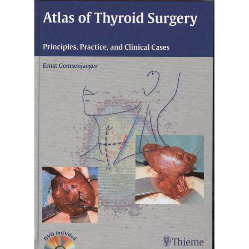 Atlas Of Thyroid Surgery