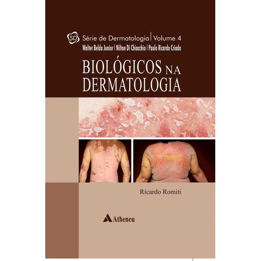 Biologicos na Dermatologia - Atheneu