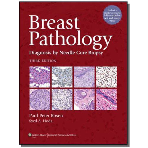 Breast Pathology - Diagnosis By Needle Core Biopsy