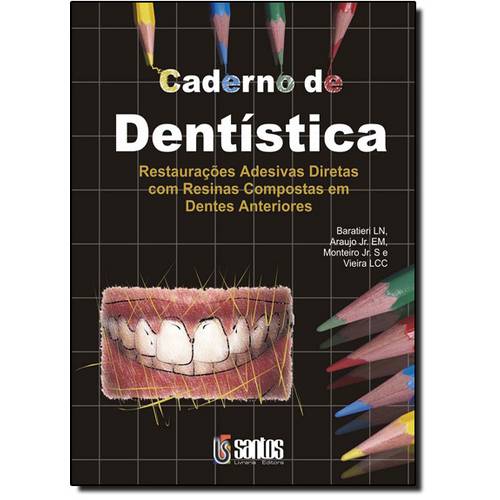 Caderno de Dentística: Restaurações Adesivas Diretas com Resinas Compostas em Dentes Anteriores