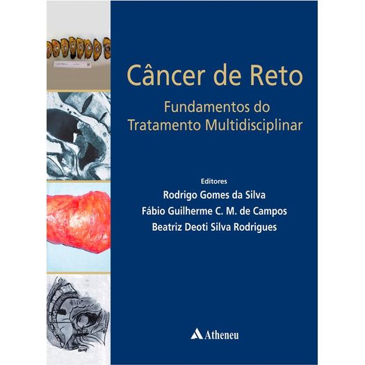 Cancer do Reto Fundamentos do Tratamento Multidisciplinar - Atheneu