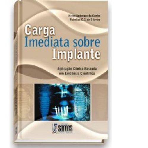 Carga Imediata Sobre Implante