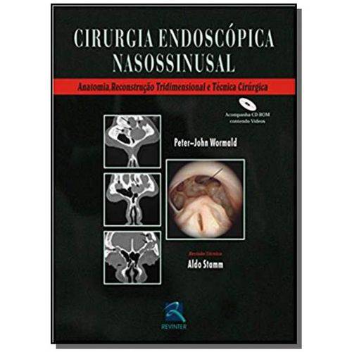 Cirurgia Endoscopica Nasossinusal