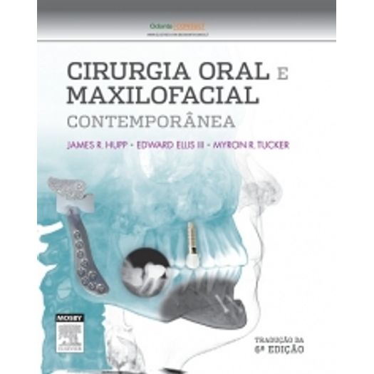 Cirurgia Oral e Maxilofacial Contemporanea - Elsevier