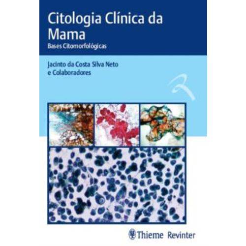 Citologia Clinica da Mama - Bases Citomorfologicas
