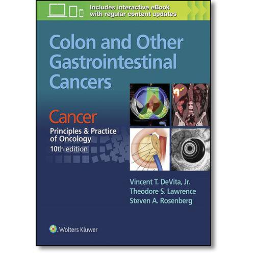 Colon And Other Gastrointestinal Cancers: Cancer - Principles & Practice Of Oncology