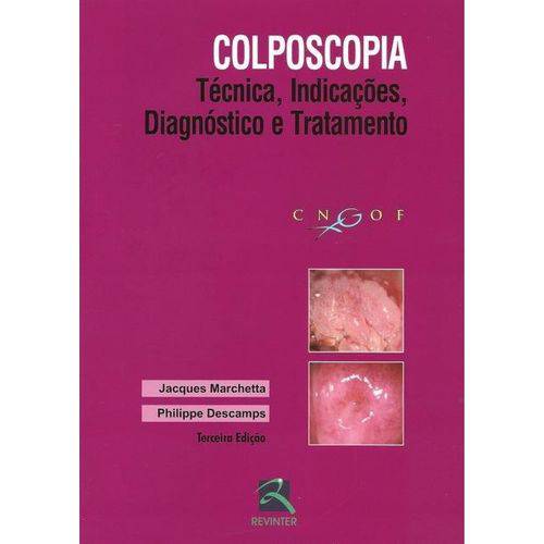 Colposcopia - Técnica, Indicações, Diagnóstico e Tratamento - 3ª Ed. 2016