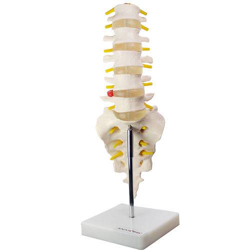 Coluna Vertebral Lombar Tgd-0145-b Anatomic
