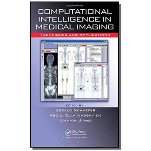 Computational Intelligence In Medical Imaging Tech