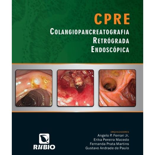 Cpre Colangiopancreatografia Retrograda Endoscopia - Rubio
