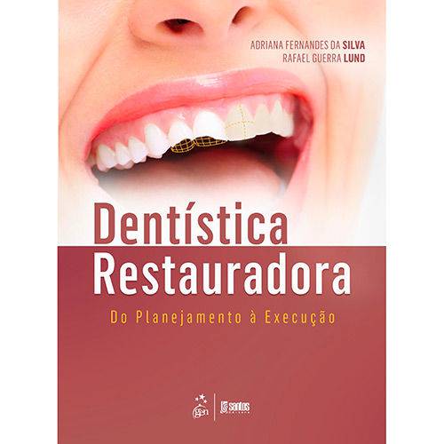 Dentística Restauradora - do Planejamento à Execução - 1ª Ed.