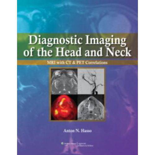 Diagnostic Imaging Of The Head And Neck - Lippincott Williams & Wilkins