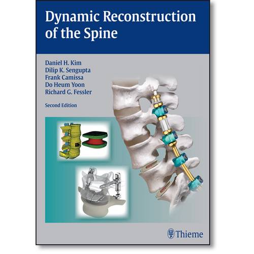 Dynamic Reconstruction Of The Spine