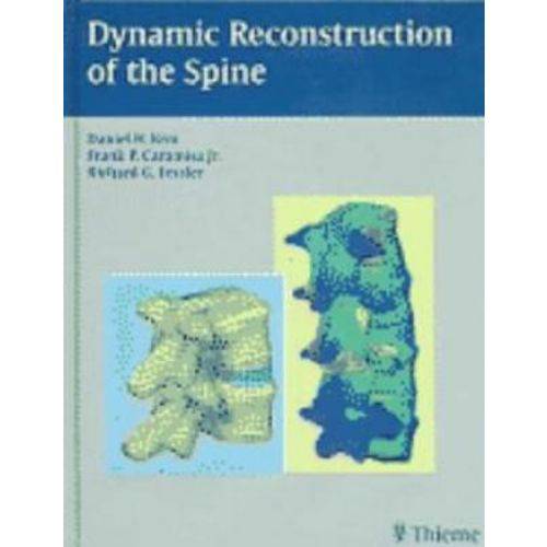 Dynamic Reconstruction Of The Spine