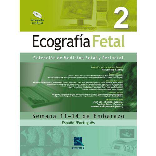 Ecografia Fetal Vol. 2