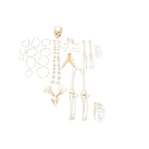 Esqueleto Humano Desarticulado - Sdorf - Cod: Sd-5003