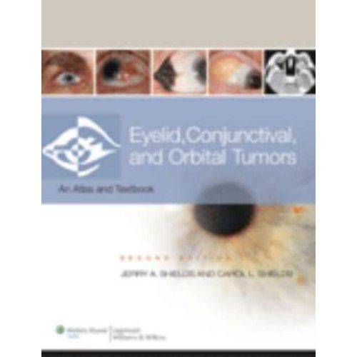 Eyelid, Conjunctival, And Orbital Tumors - 2nd Ed
