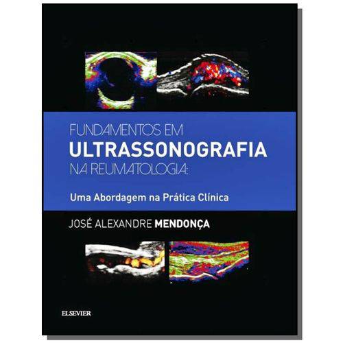 Fundamentos em Ultrassonografia na Reumatologia: U