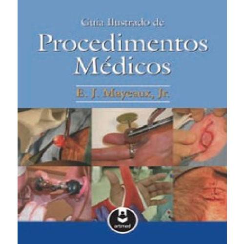 Guia Ilustrado de Procedimentos Medicos