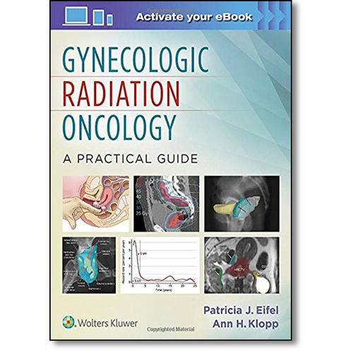 Gynecologic Radiation Oncology: a Practical Guide