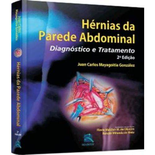 Hernias da Parede Abdominal - Diagnostico e Tratamento