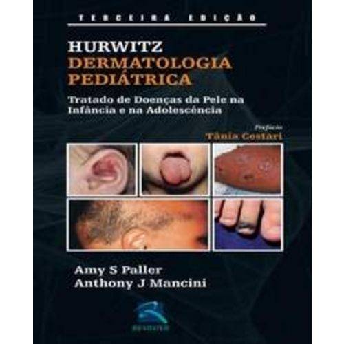 Hurwitz Dermatologia Pediatrica - Revinter