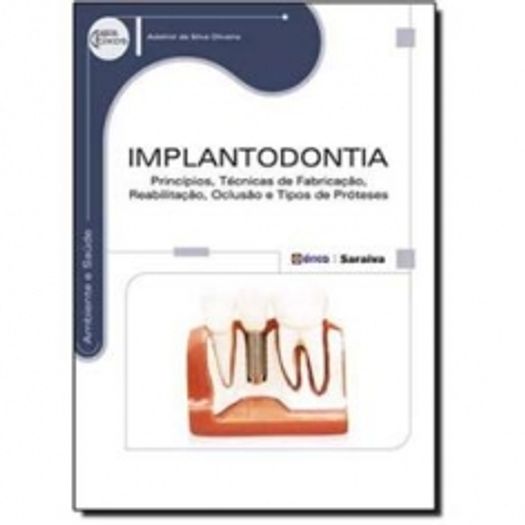 Implantodontia - Erica