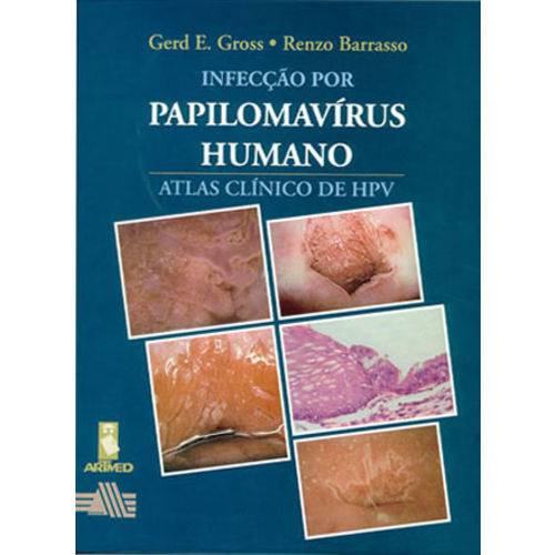 Infeccao por Papilomavirus Humano